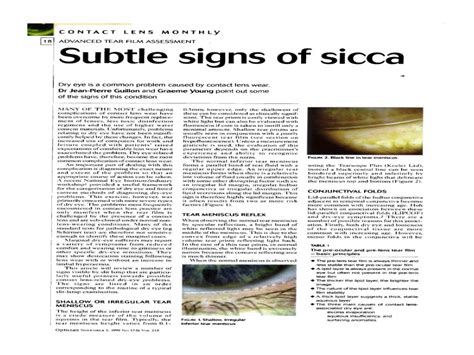 Subtle Signs of Sicca 